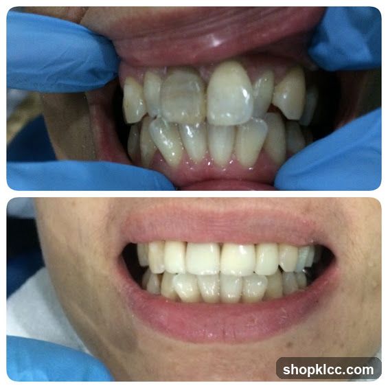 Dental Treatment Before and After