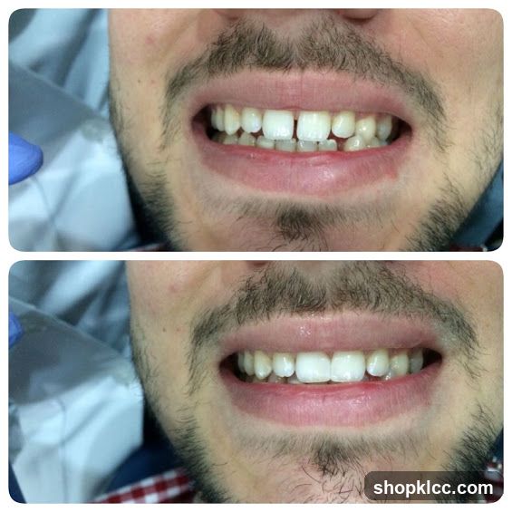 Dental Treatment Before and After