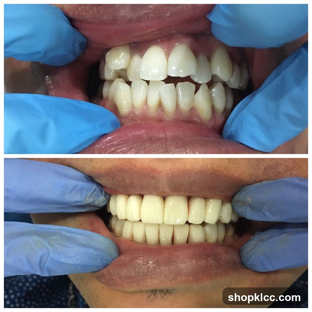 Dental Examination