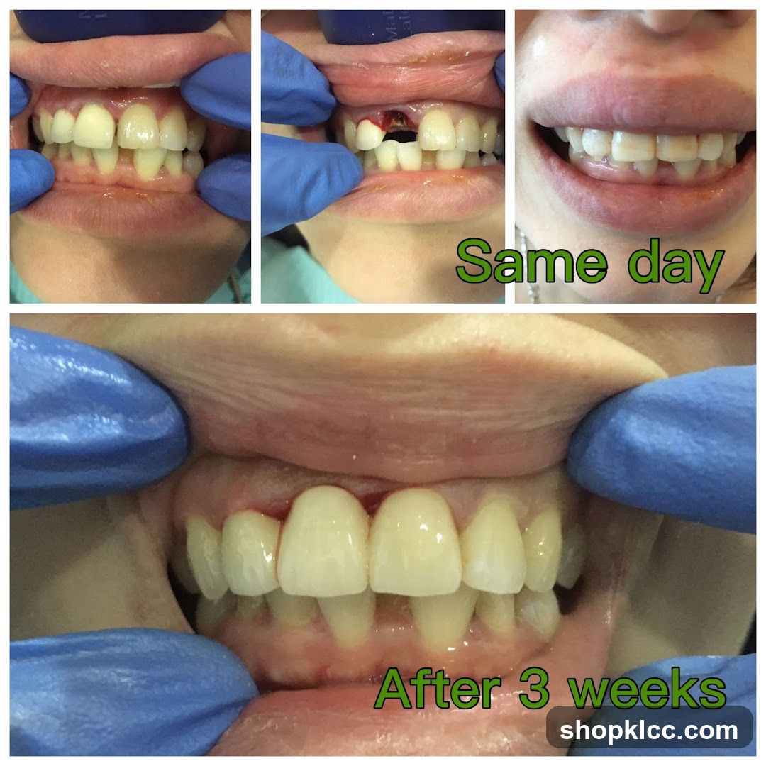 Dental Treatment Before and After