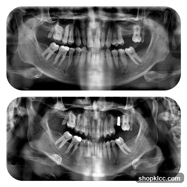 Dental X-ray Panoramic View
