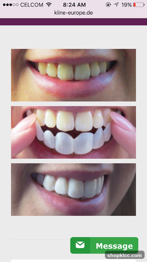 Dental Treatment Before and After