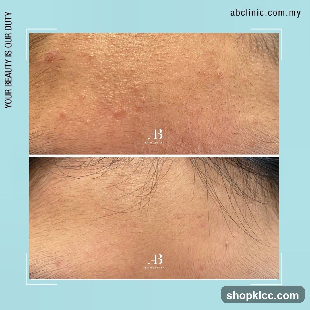 Before and After Skin Treatment Comparison