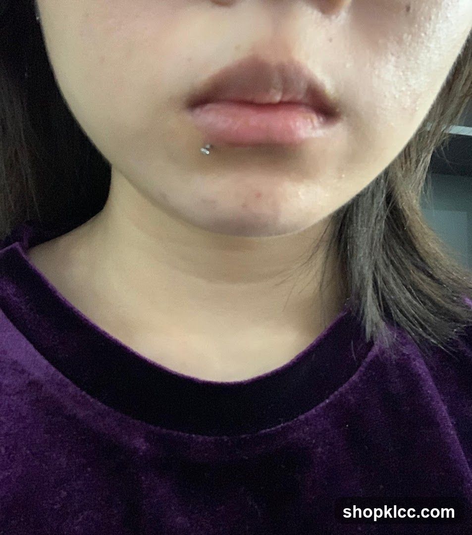 Close-up of a person's lower face and neck