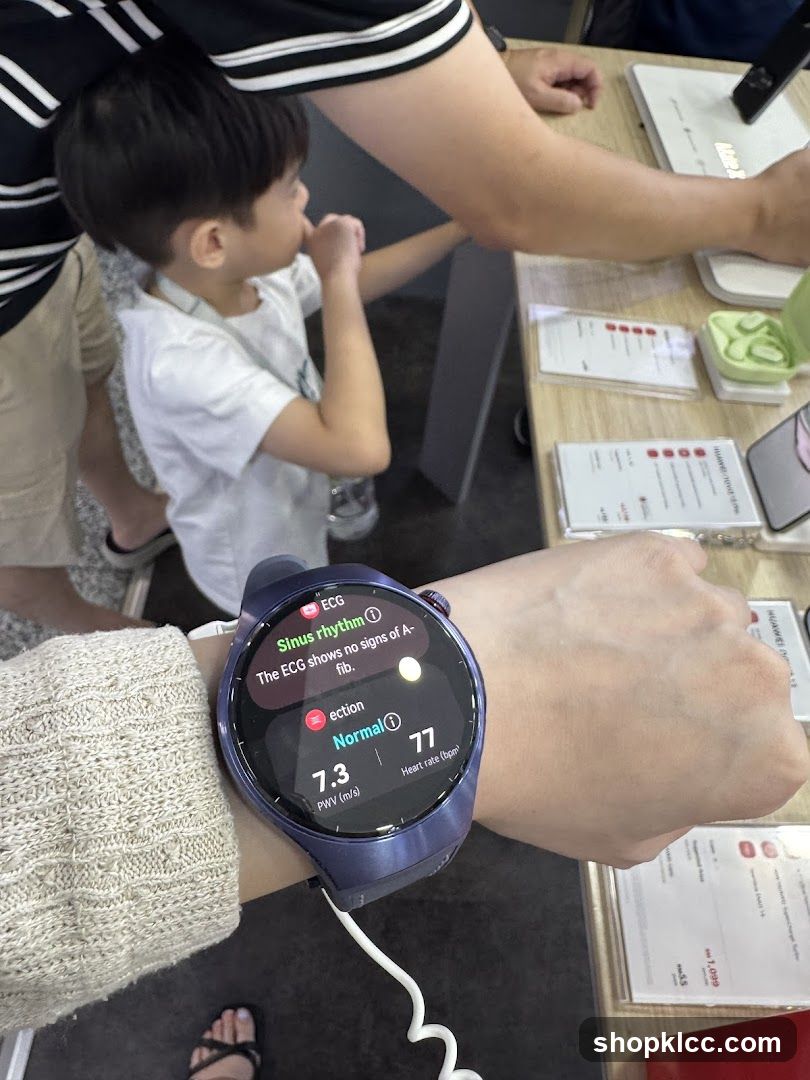 Smartwatch ECG Reading