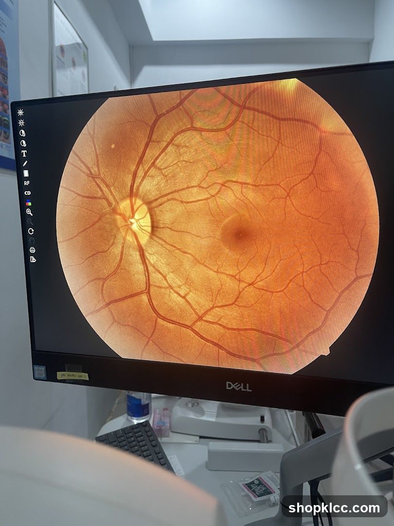 Retinal Scan Display