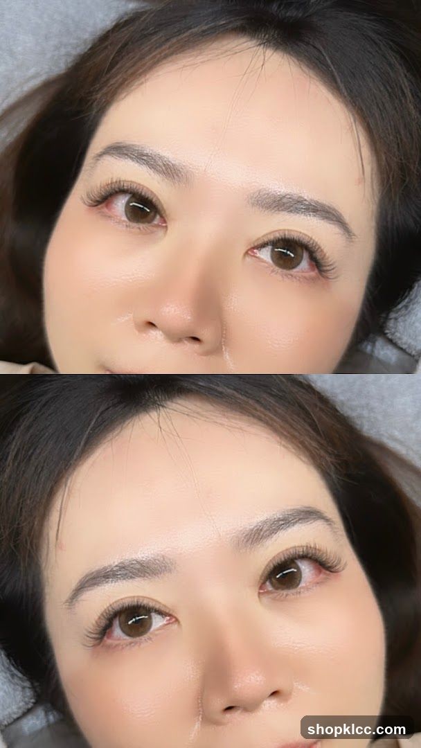 Beauty Treatment Before and After