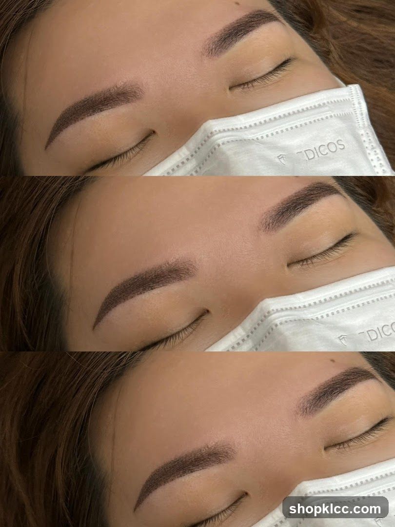 EYEBROW TREATMENT BEFORE AND AFTER