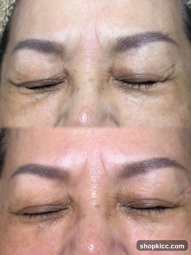 Face Close-Up Comparison