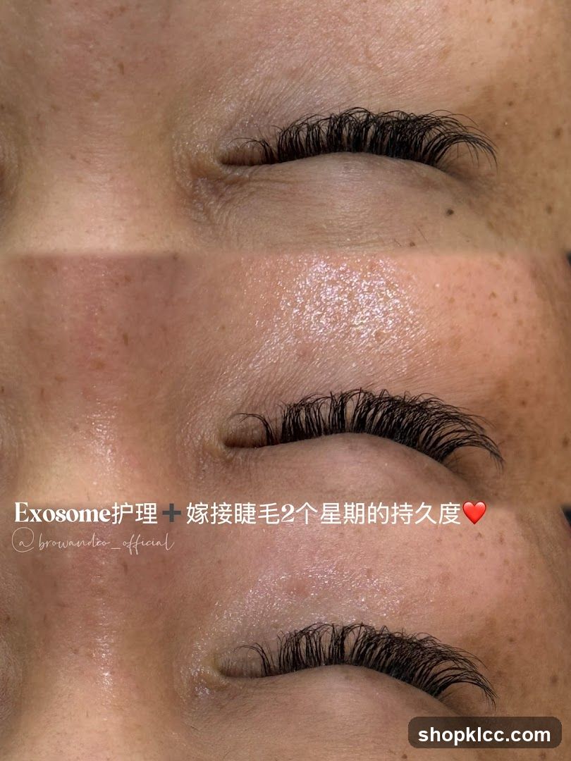 Exosome护理 + 嫁接睫毛2个星期的持久度
