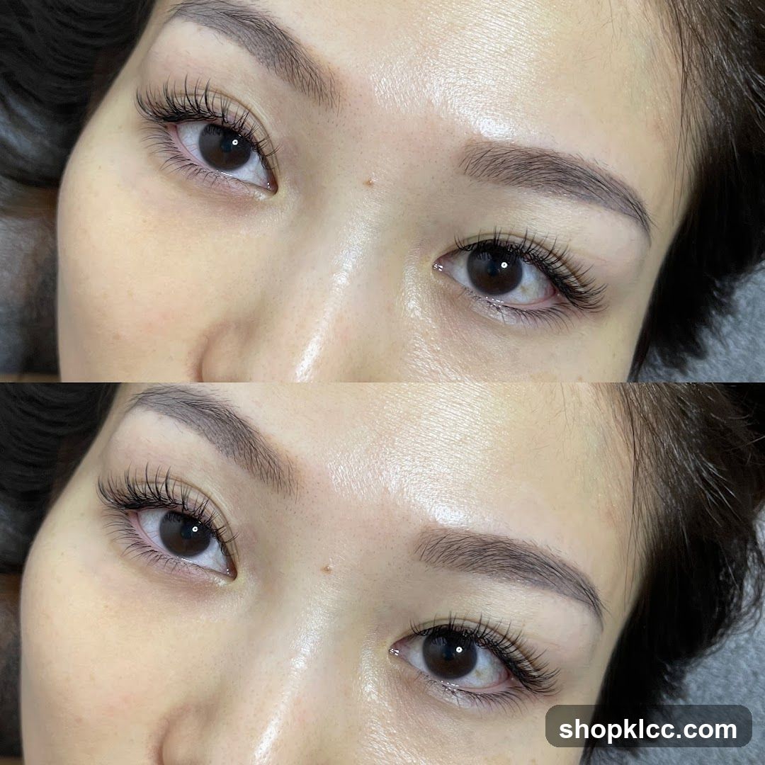 Beauty Treatment Before and After