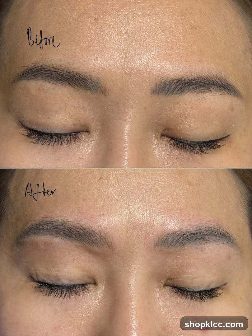 Before and After Eyebrow Treatment