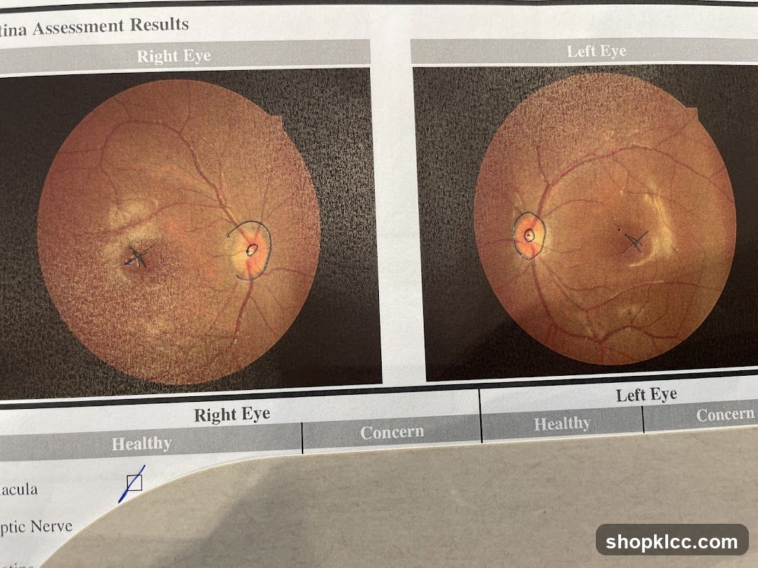 Retina Assessment Results