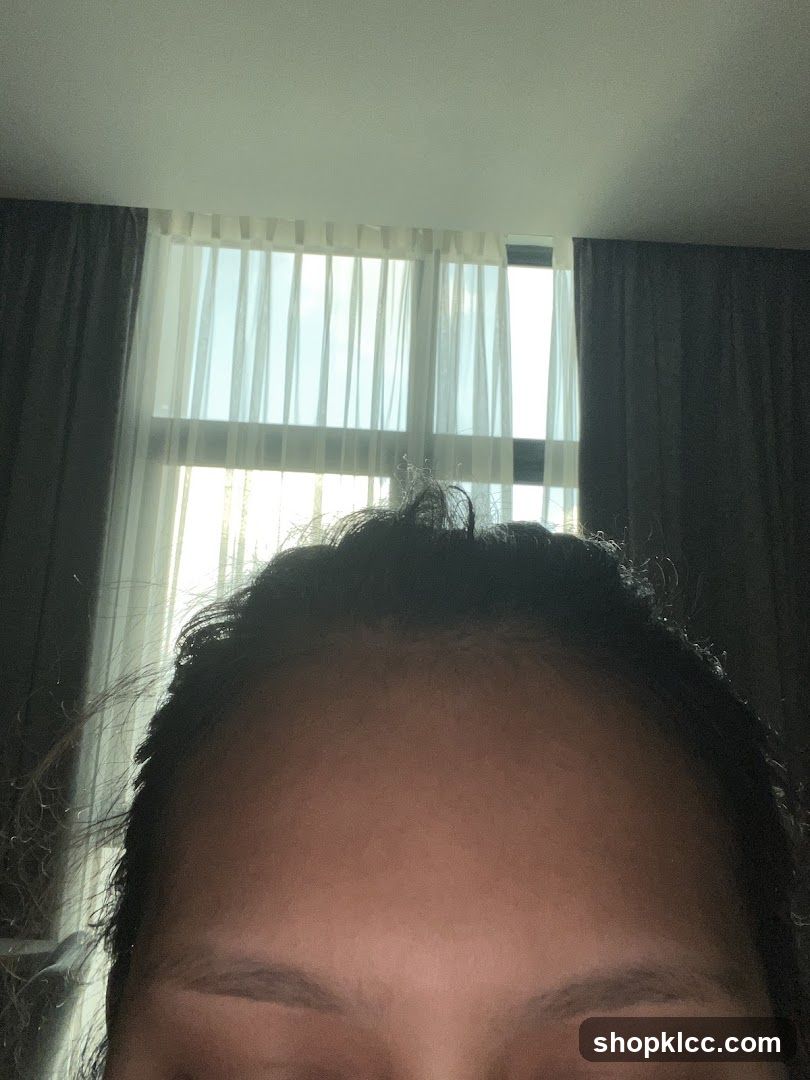 Close-up of forehead and hair near window