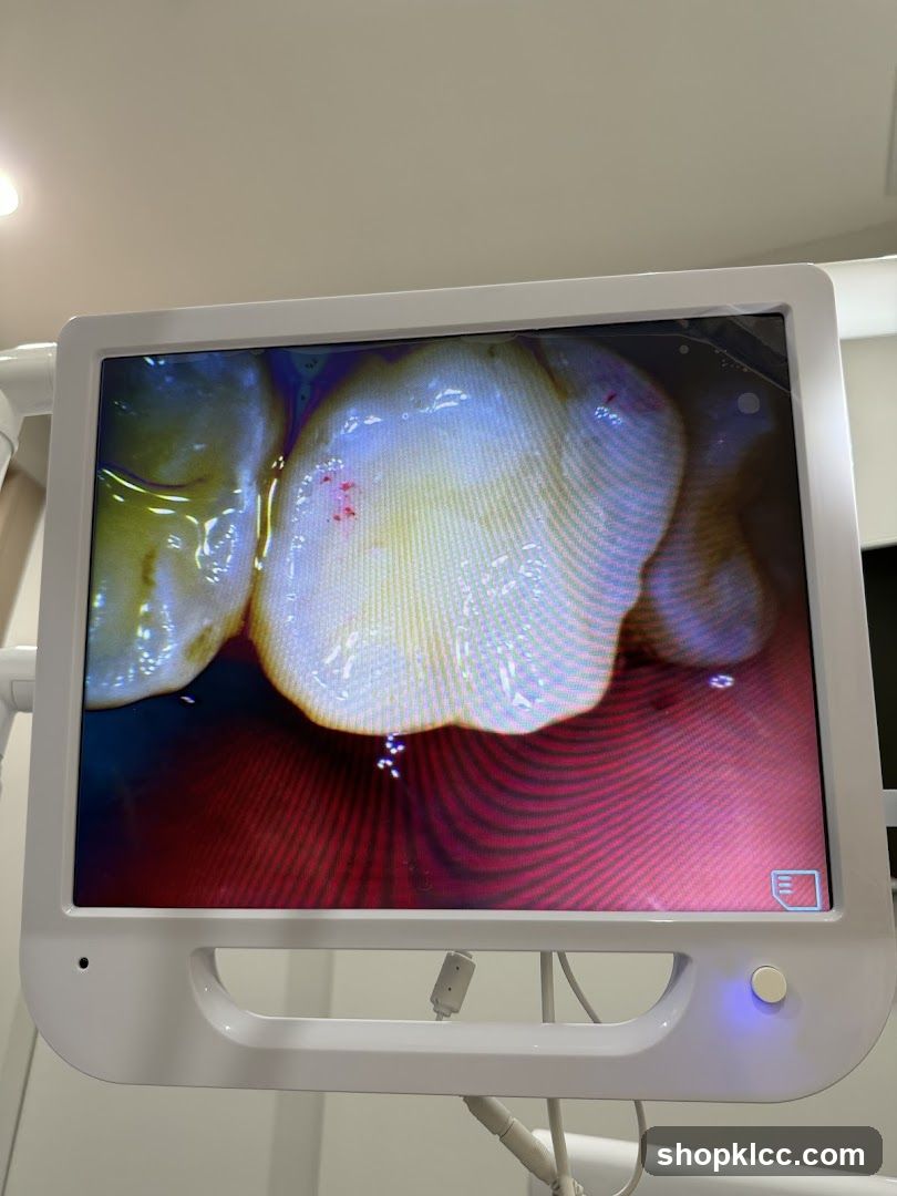 Dental Intraoral Camera Display