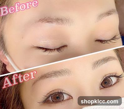 Before and After Eyelash Enhancement