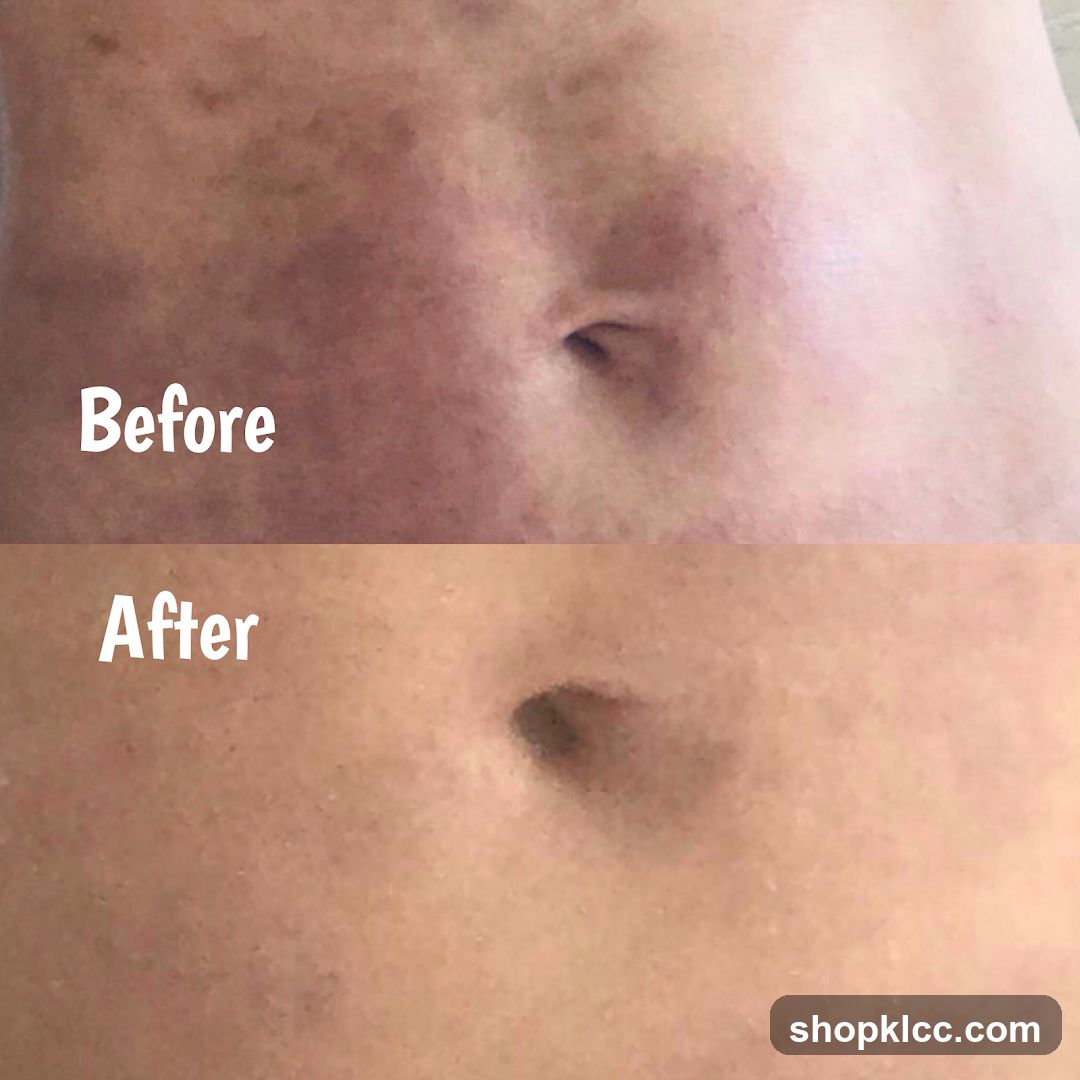 Before and After Belly Button Comparison