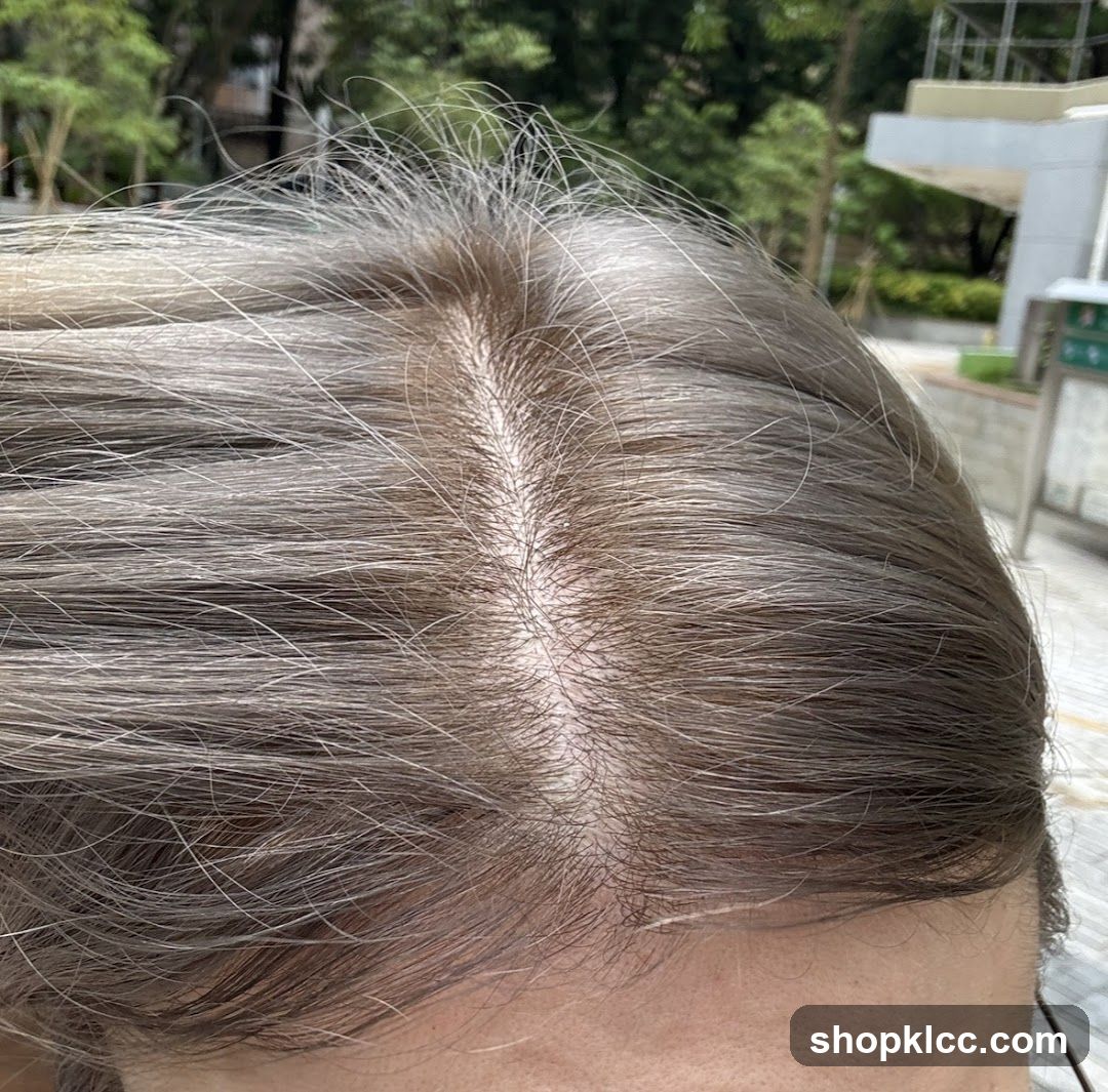 Close-up of a person's scalp and hair