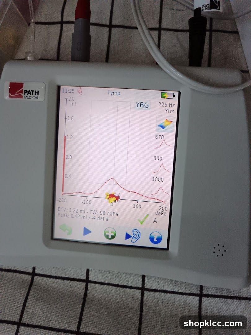 Tympanometry Monitor Display