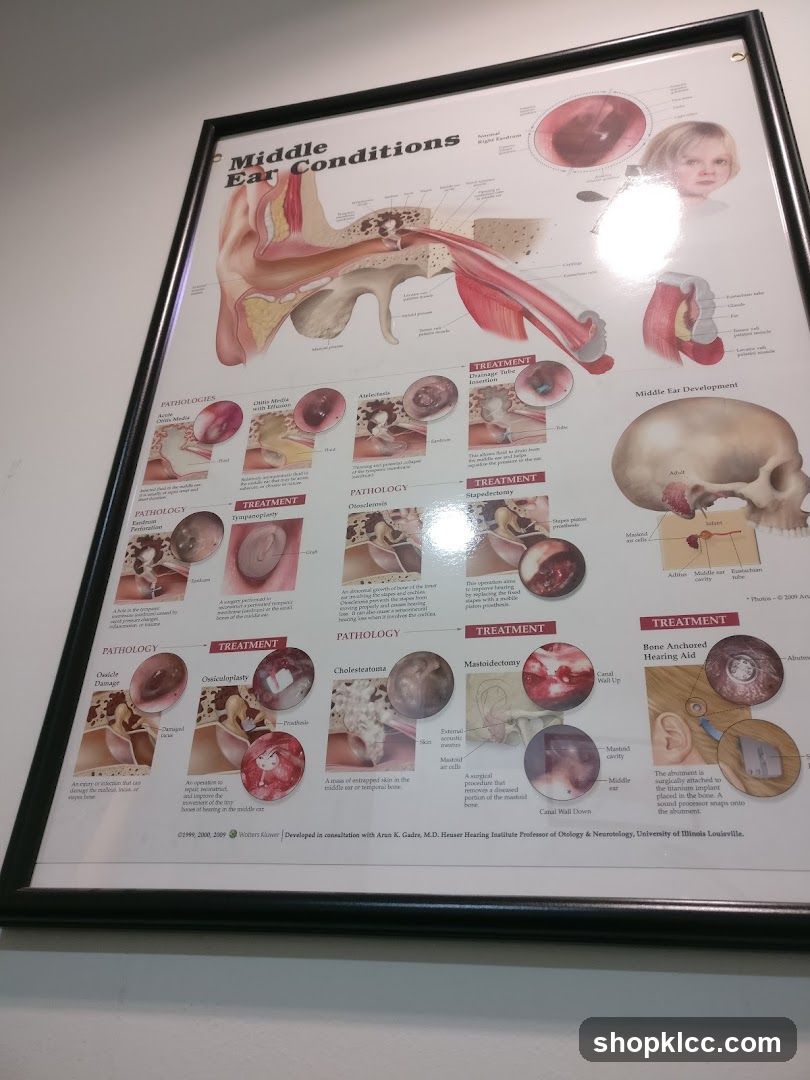 Middle Ear Conditions Educational Poster