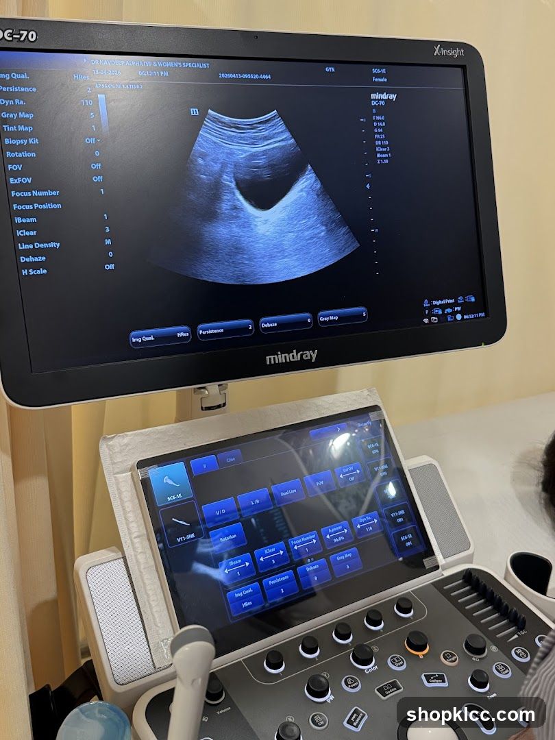 Ultrasound Machine Display