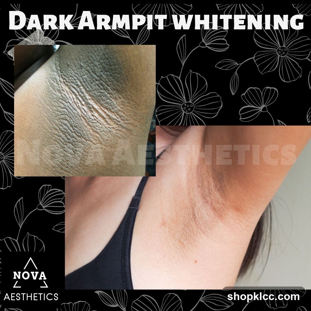 Nova Aesthetics