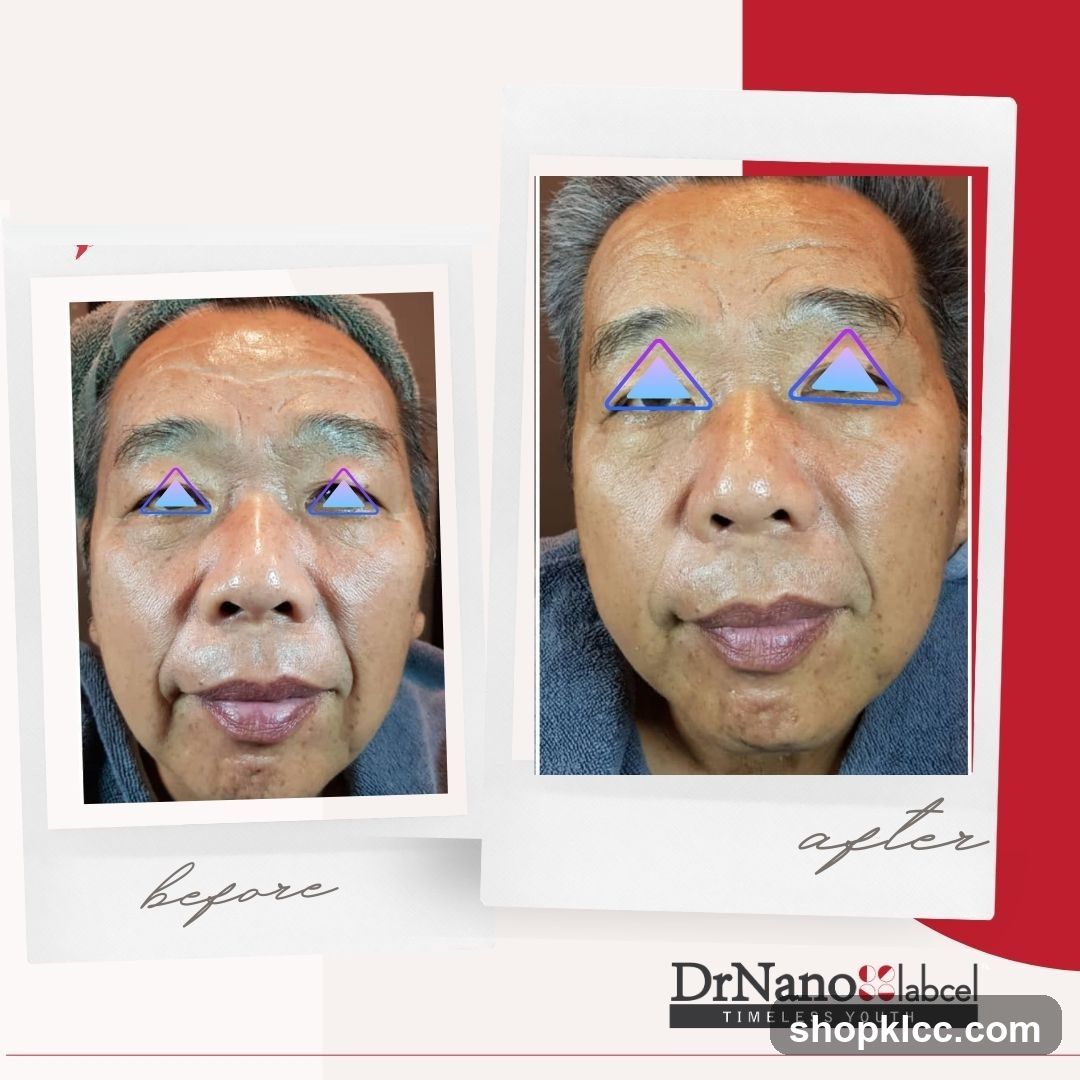Before and After Facial Treatment