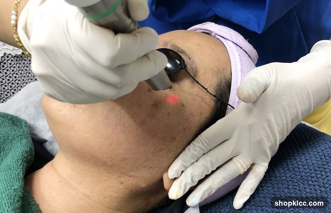 Medical Procedure with Laser Treatment