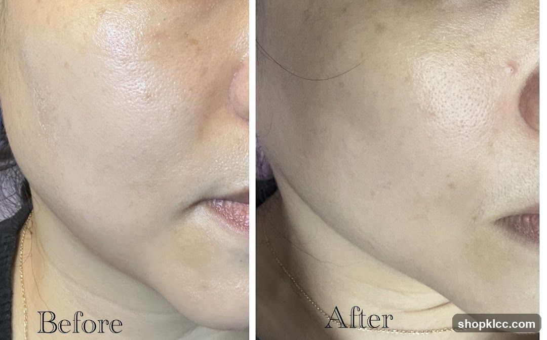 Skin Comparison Before and After