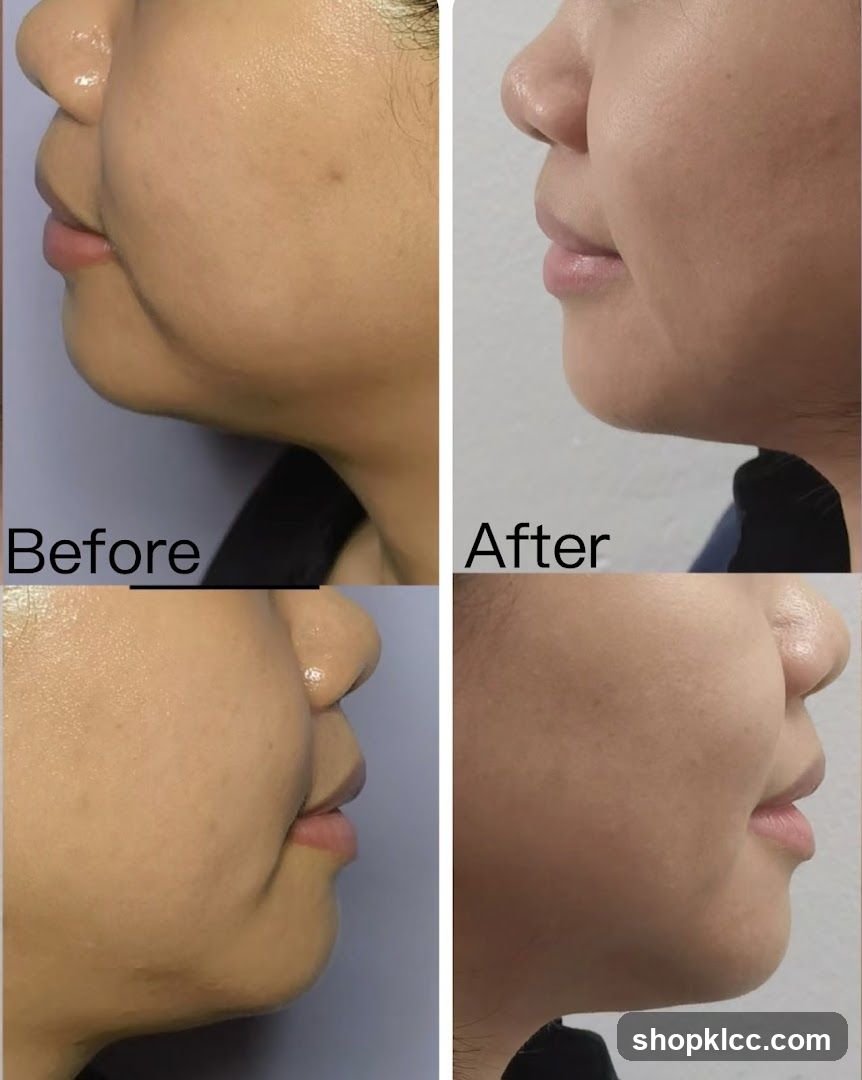 Before and After Facial Comparison