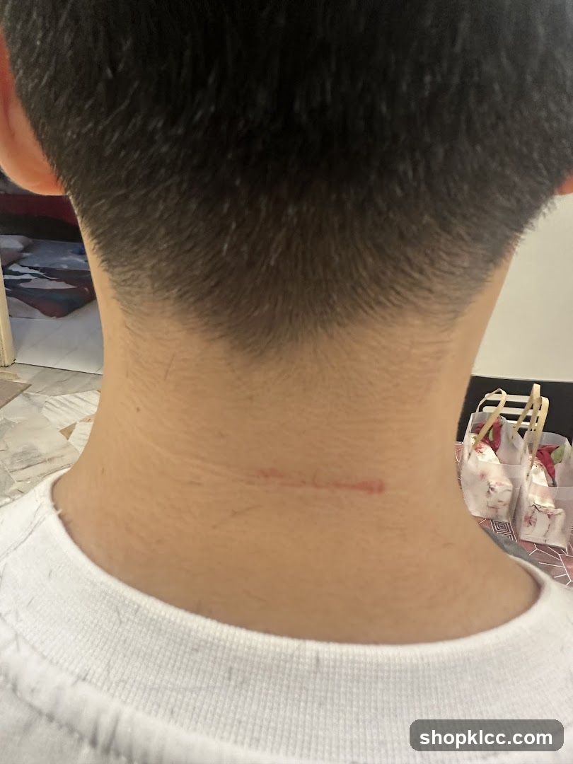 Scar on Neck