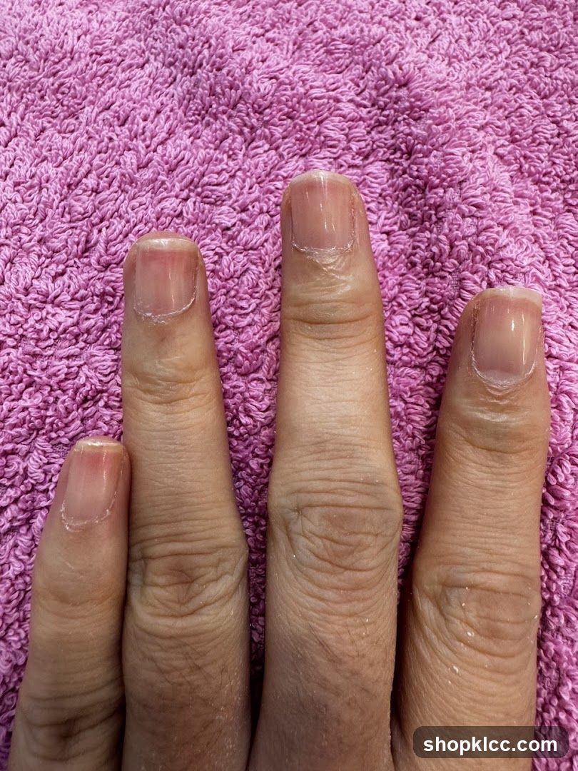 Fingers with clear nail polish