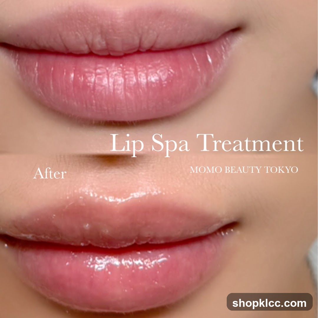 Lip Spa Treatment Before and After