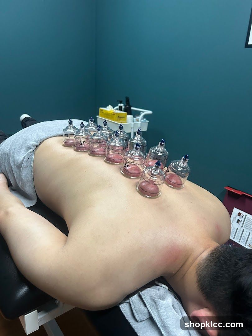 Cupping Therapy