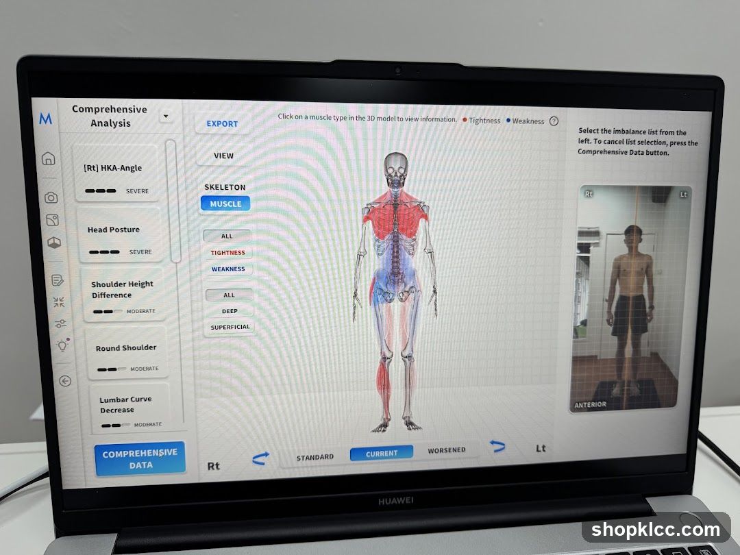 Body Analysis Software