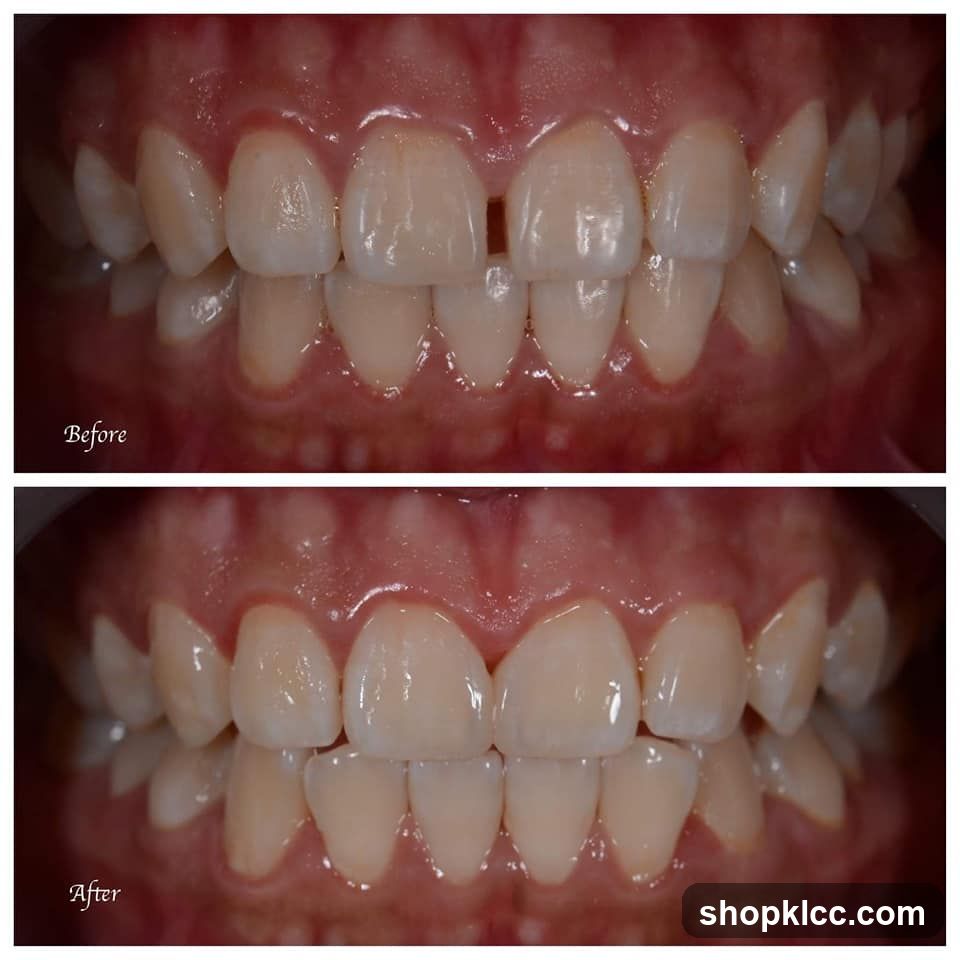 Before and After Dental Treatment