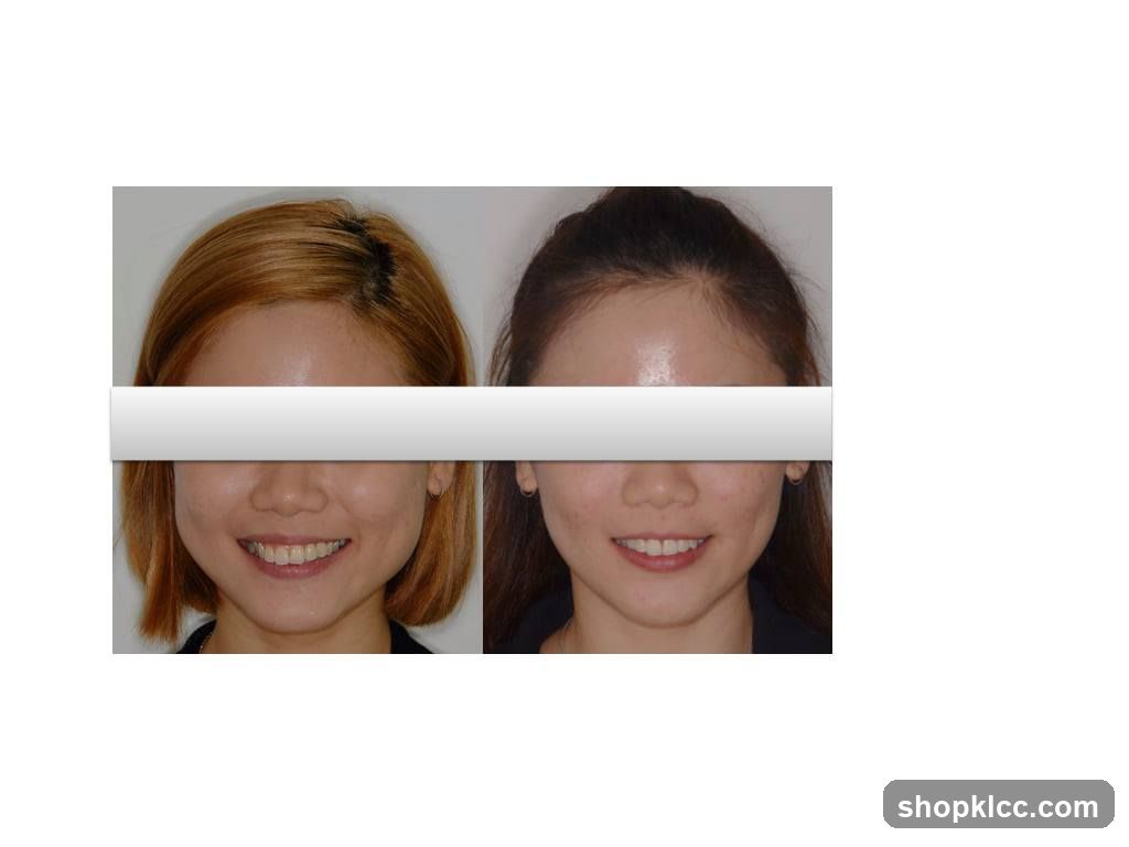Before and After Facial Comparison