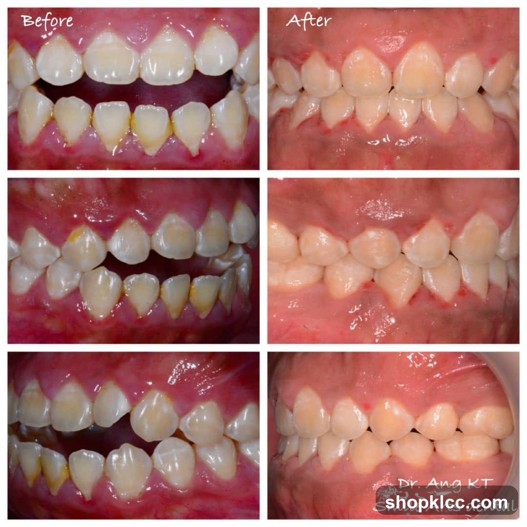 Dental Treatment Before and After Comparison