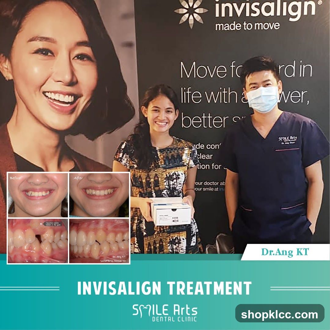 Invisalign Treatment Advertisement