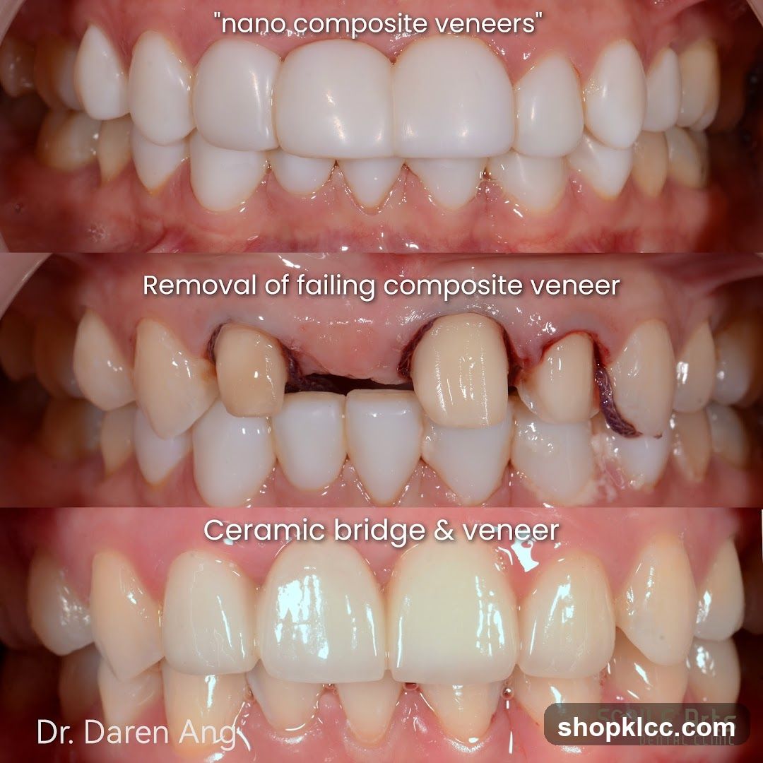 Dental Treatment Comparison