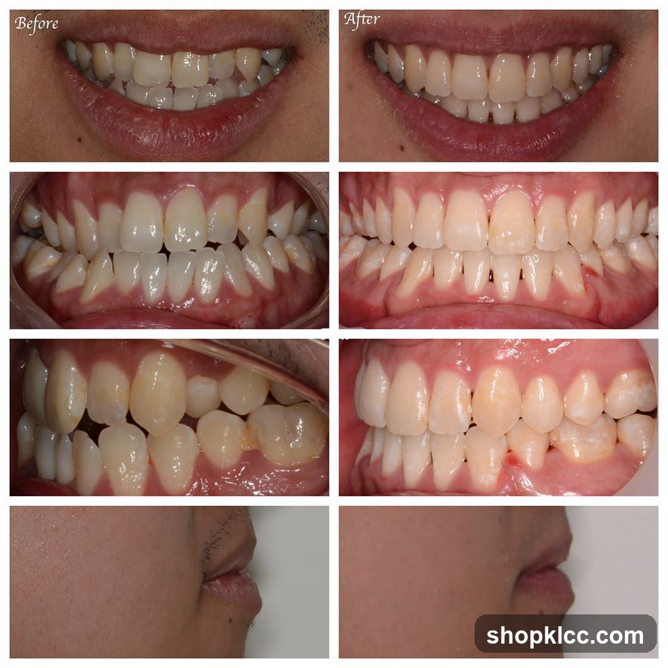 Dental Treatment Comparison