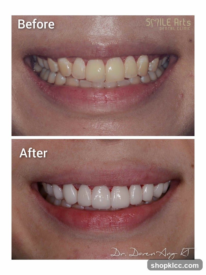 Dental Before and After
