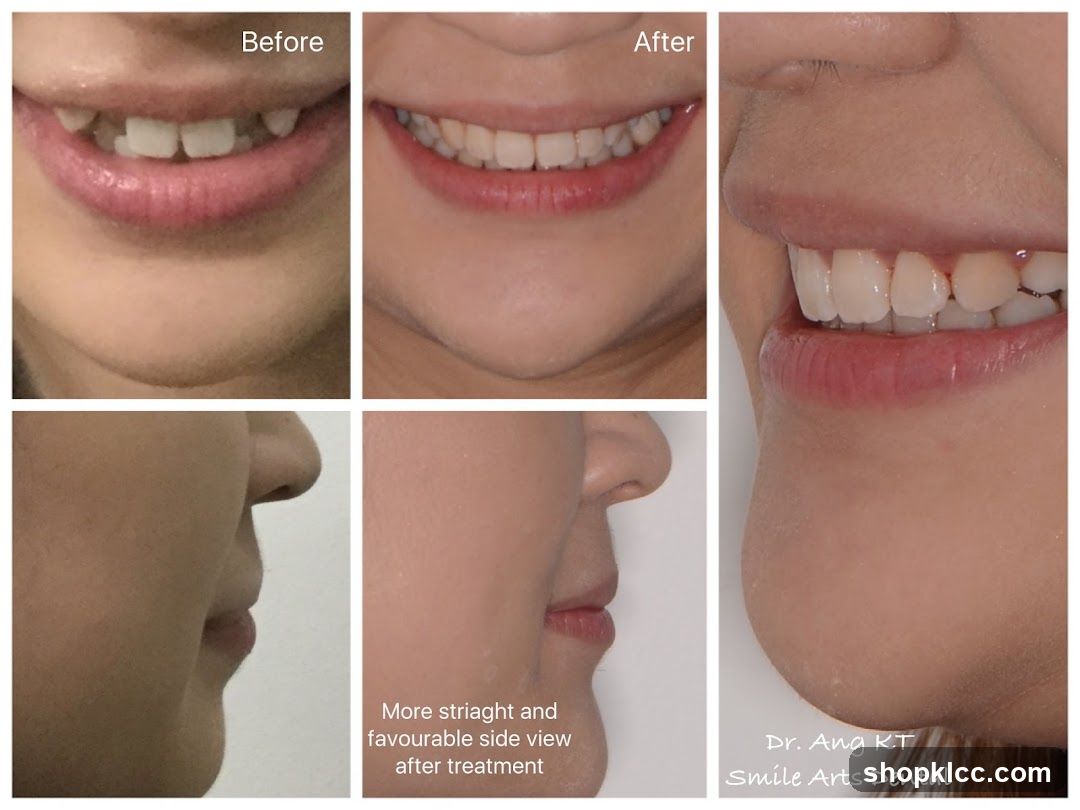Dental Treatment Before and After Comparison