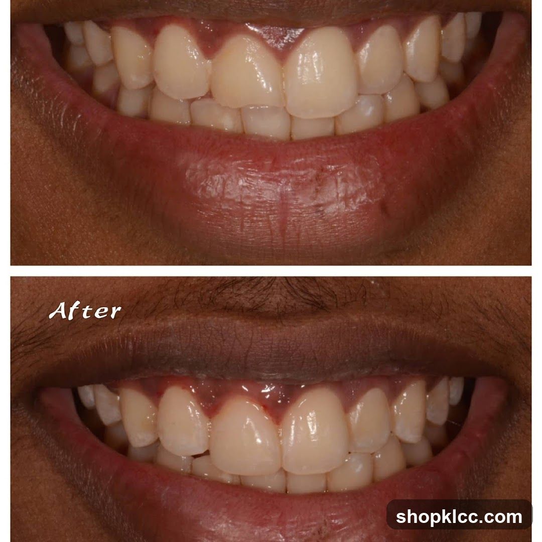 Dental Smile After Treatment