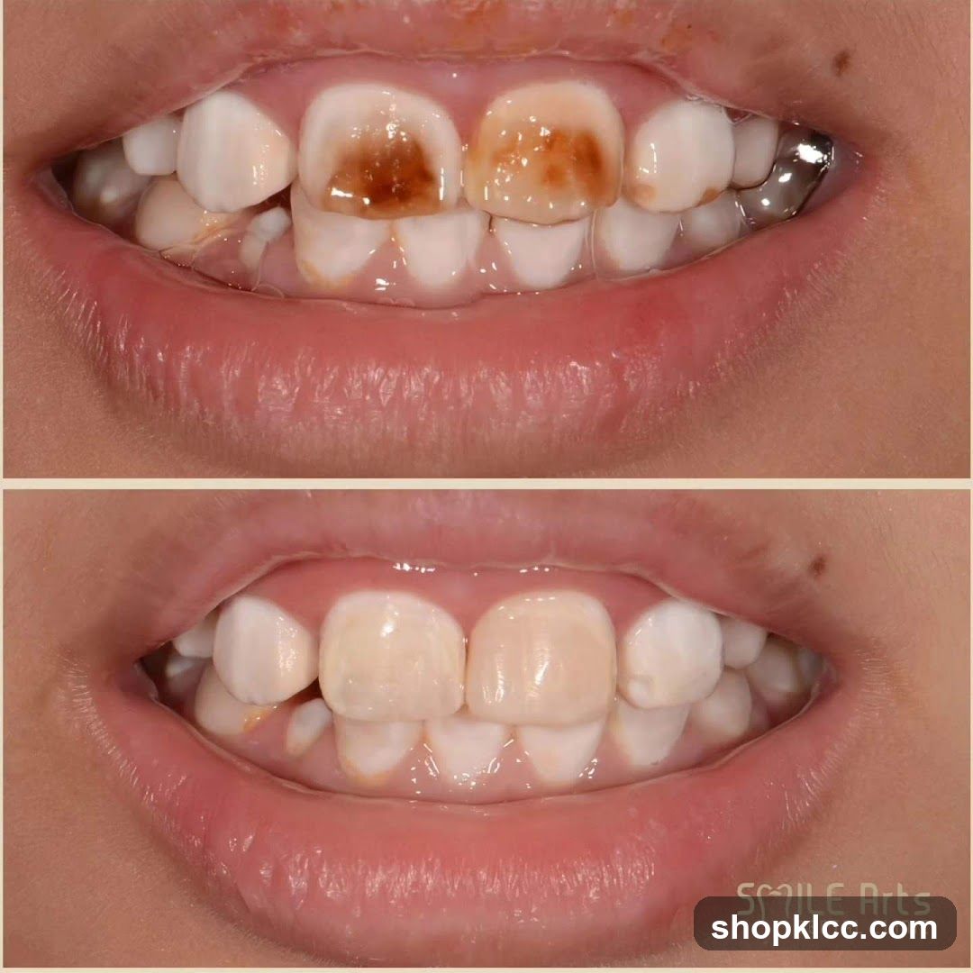 Dental Treatment Before and After