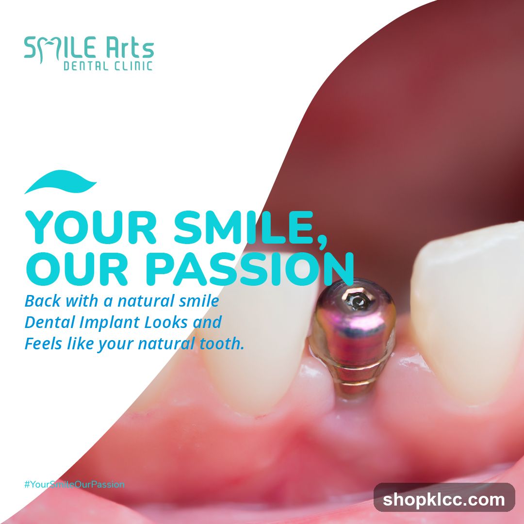 Dental Implant Advertisement