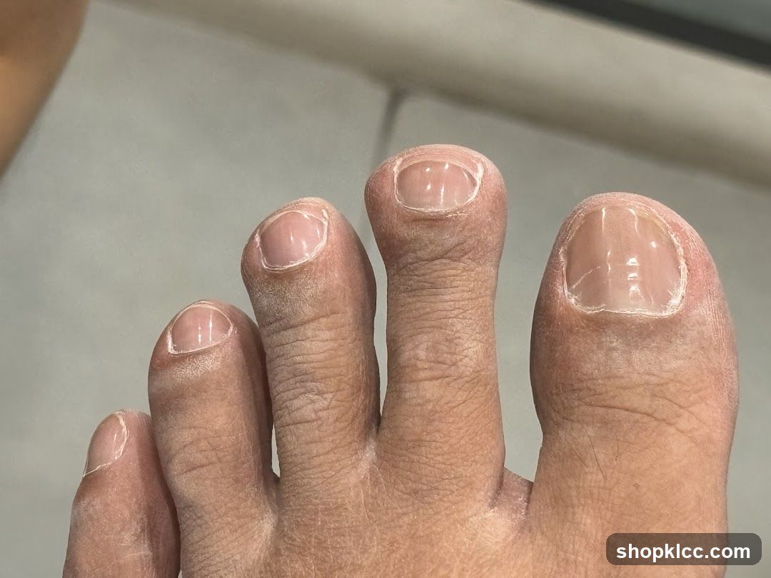 Close-up of Toes