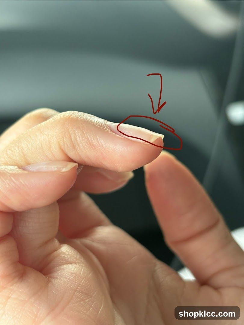 Close-up of a fingernail with a red circle and arrow
