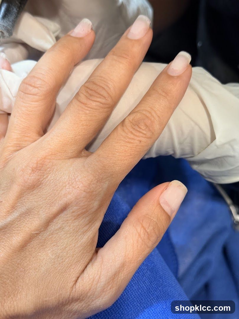 Nail Preparation