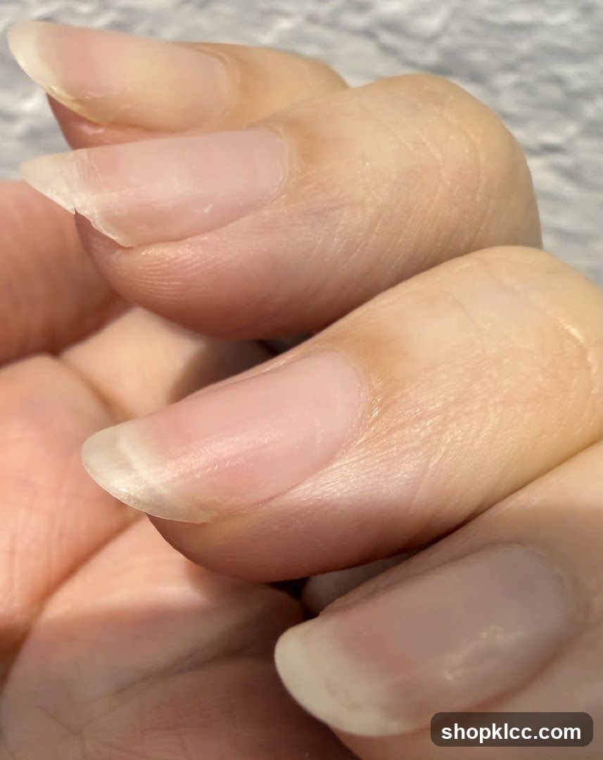 Close-up of fingernails
